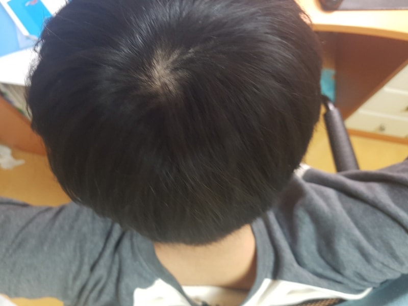 KakaoTalk_20170310_224011256.jpg