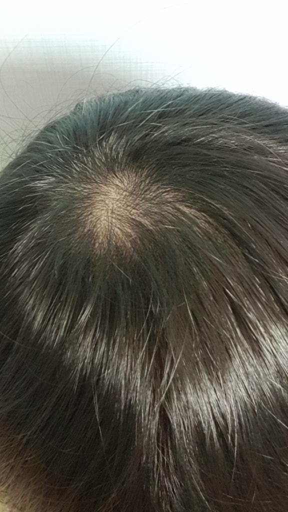 20190316_194307.jpg