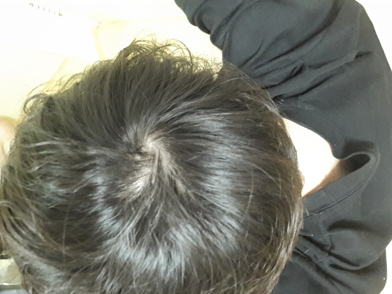 20180309_224017.jpg
