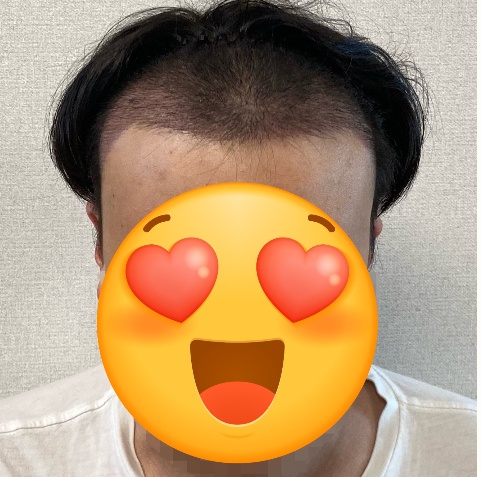 문중산 에프터.PNG