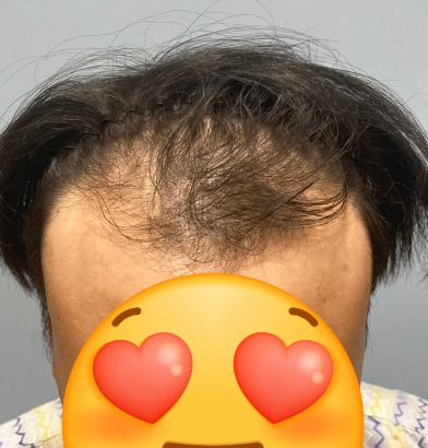 문중산 비포.PNG