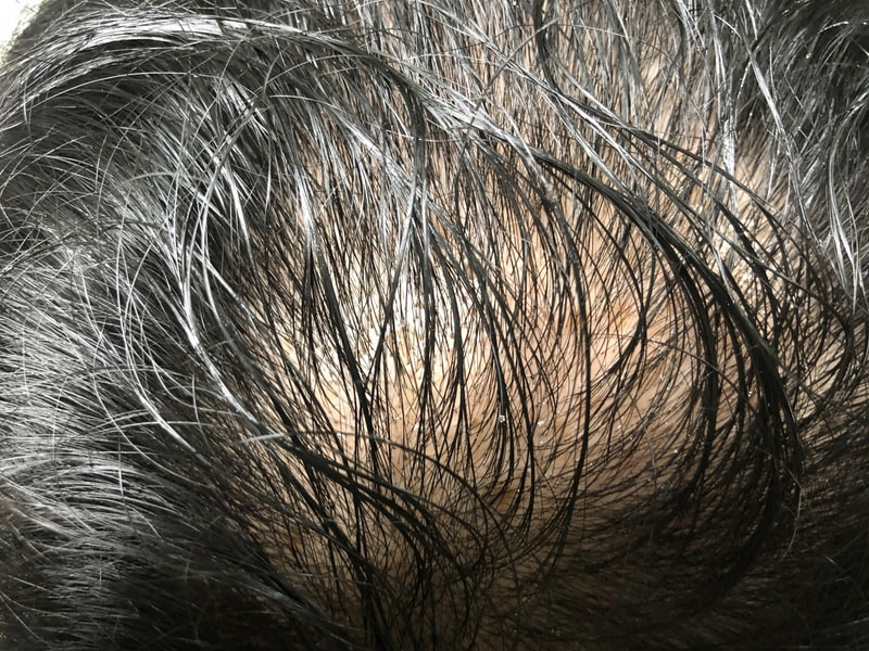 B87921CA-9AC0-4E3F-8DC9-C5D1FE2CC4DF.jpeg