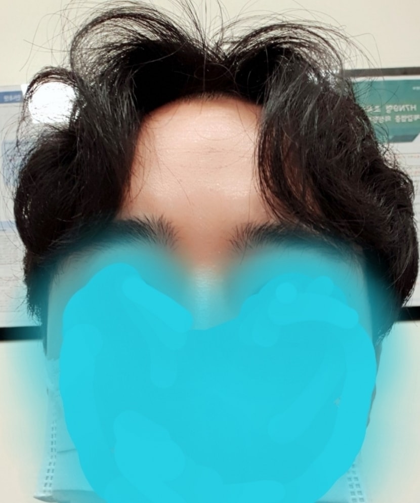 커버