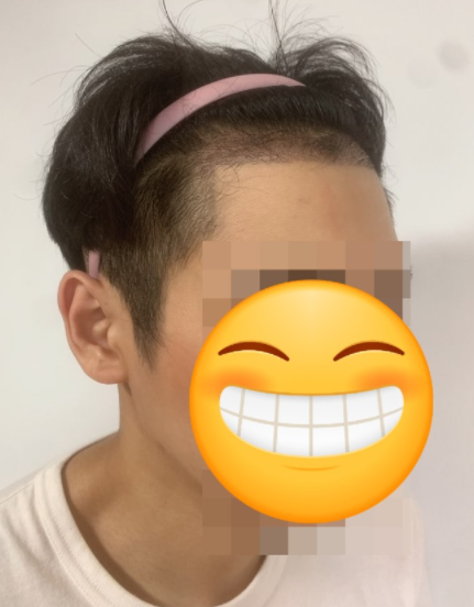 박호렬 수술 후14일차.PNG