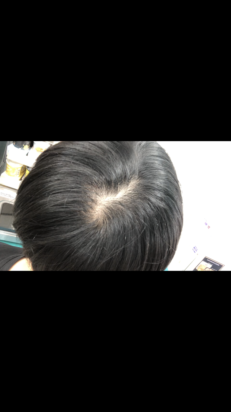 D8C50340-CB22-4713-9BD7-98ED17F7CB5B.png