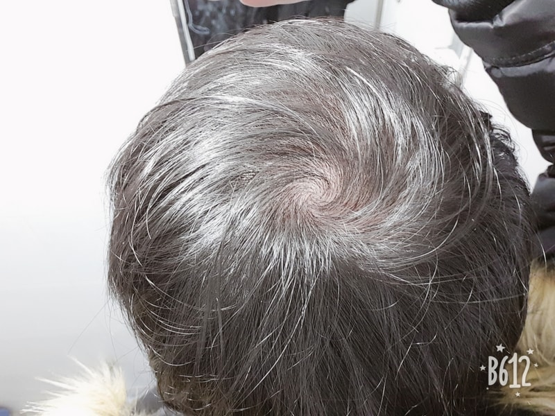 B612_20181207_102459_570.jpg