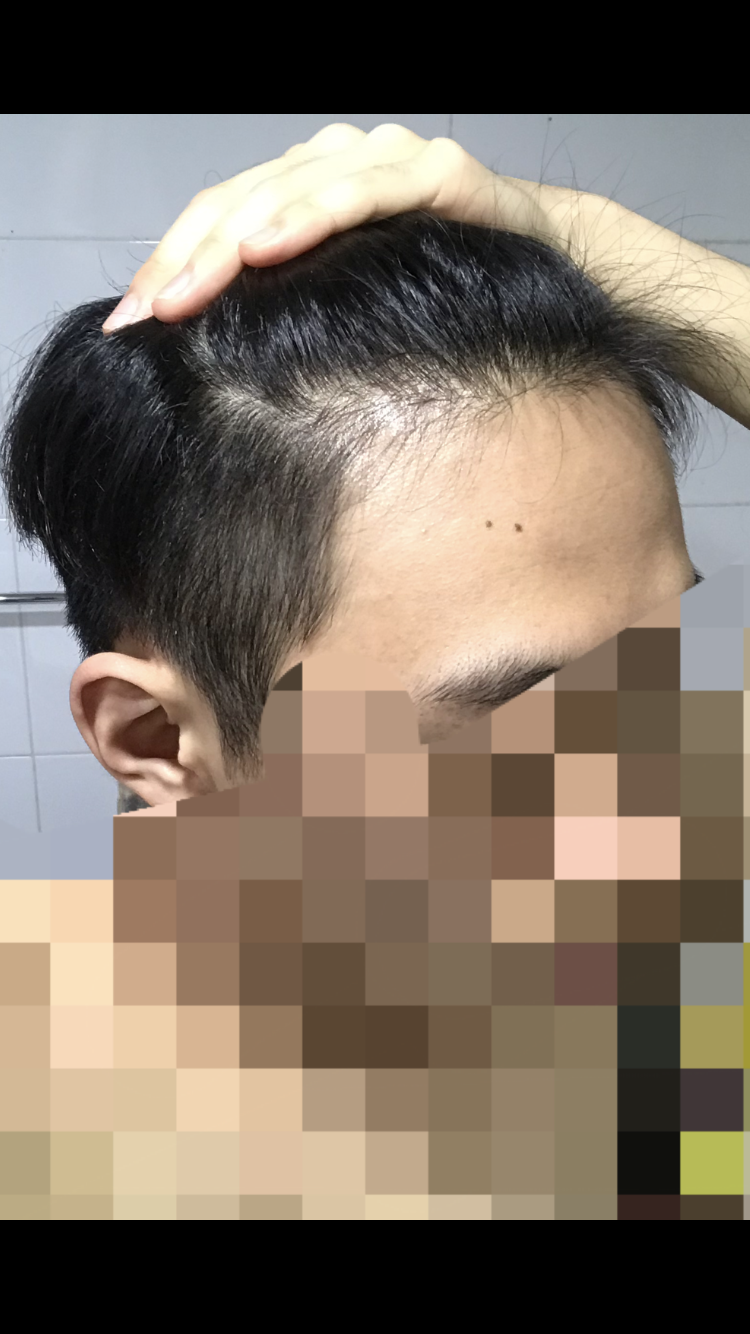 FD92AB7D-7121-420C-987E-0924C70ADDD0.png
