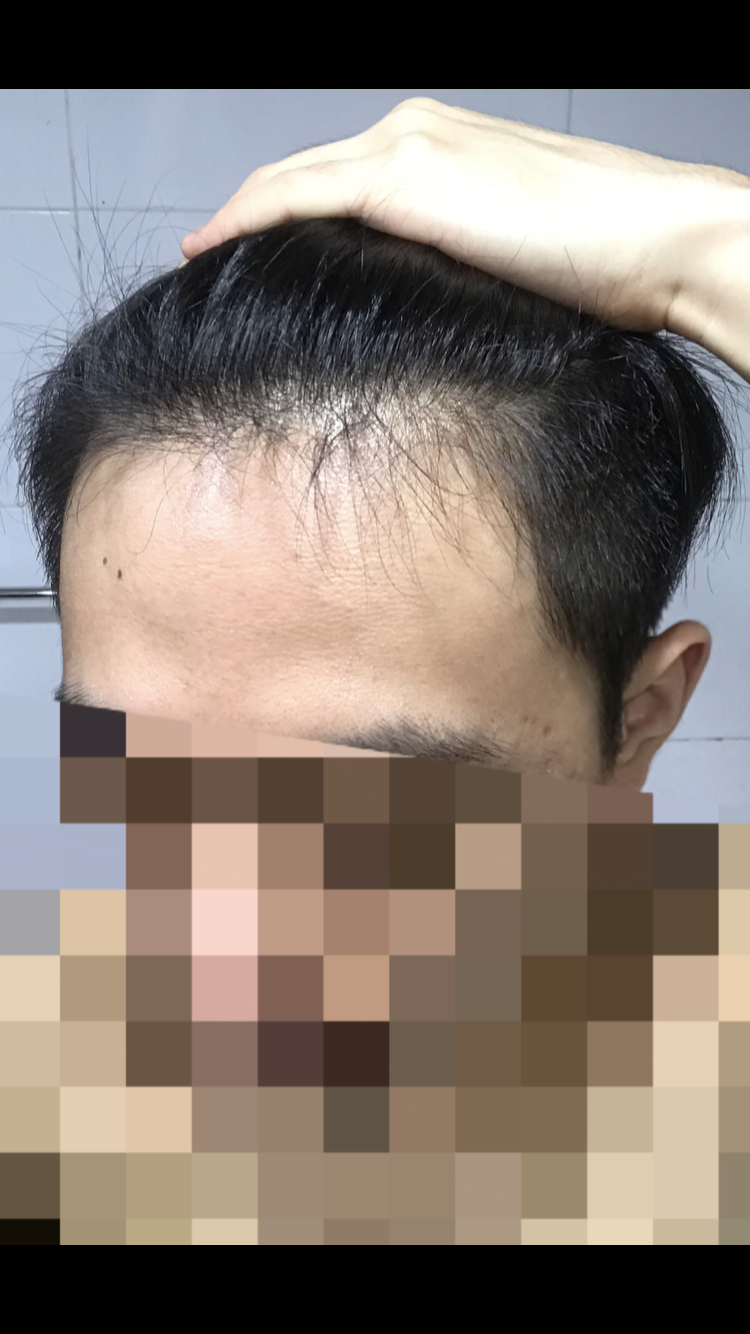 D63305B3-874B-40AC-9CC0-556F6038B148.png