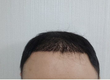 이두열7일2.PNG