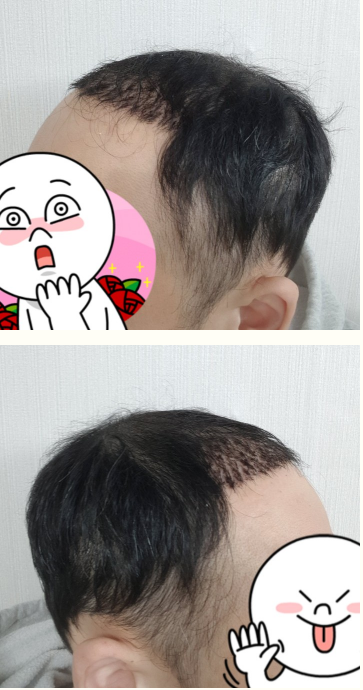 이두열7일.PNG