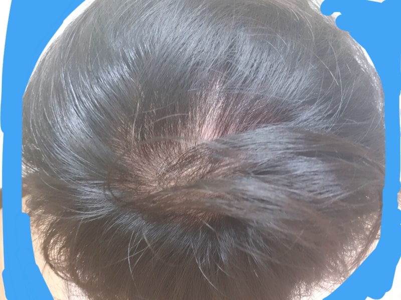 20180625_205154.jpg