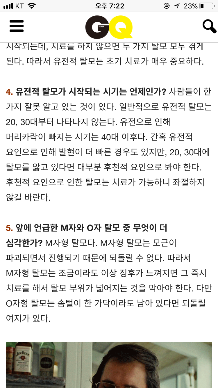 유전탈모는 40세 이상부터 나타난다??