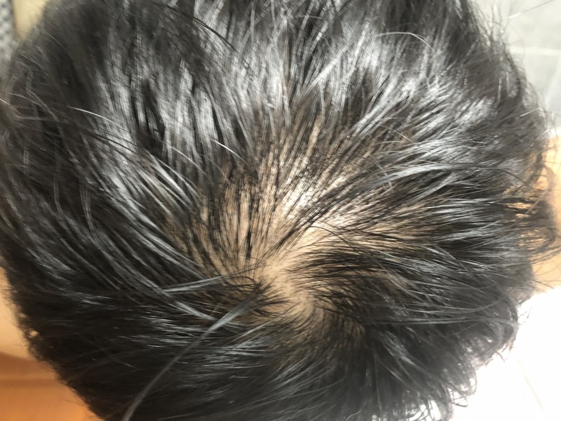 A22CFA95-C43D-4091-A854-19F1ADDF93DF.jpeg