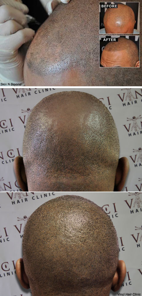 hairtatoo232.jpg