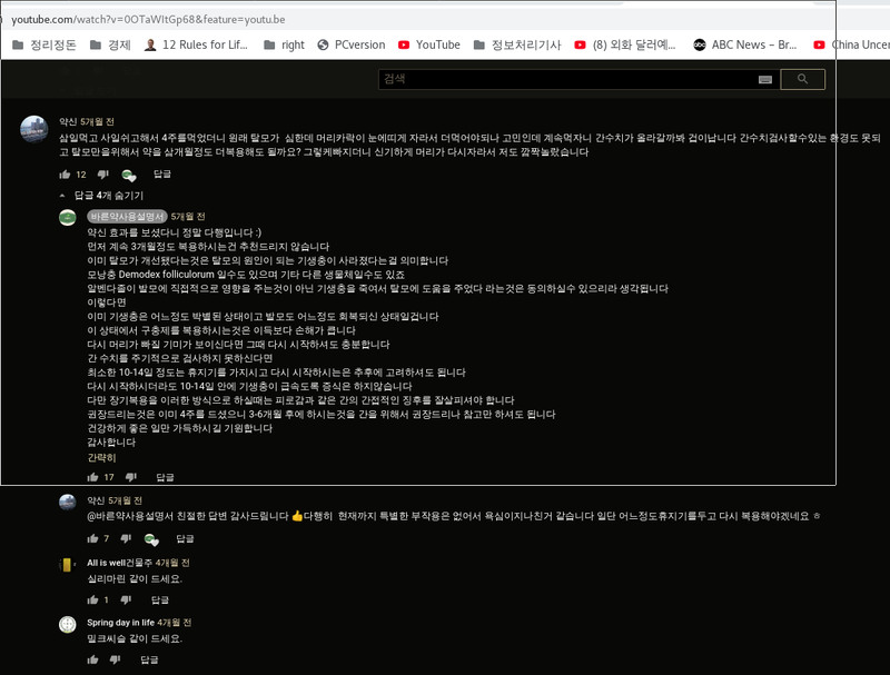 알벤다졸 탈모치료.png
