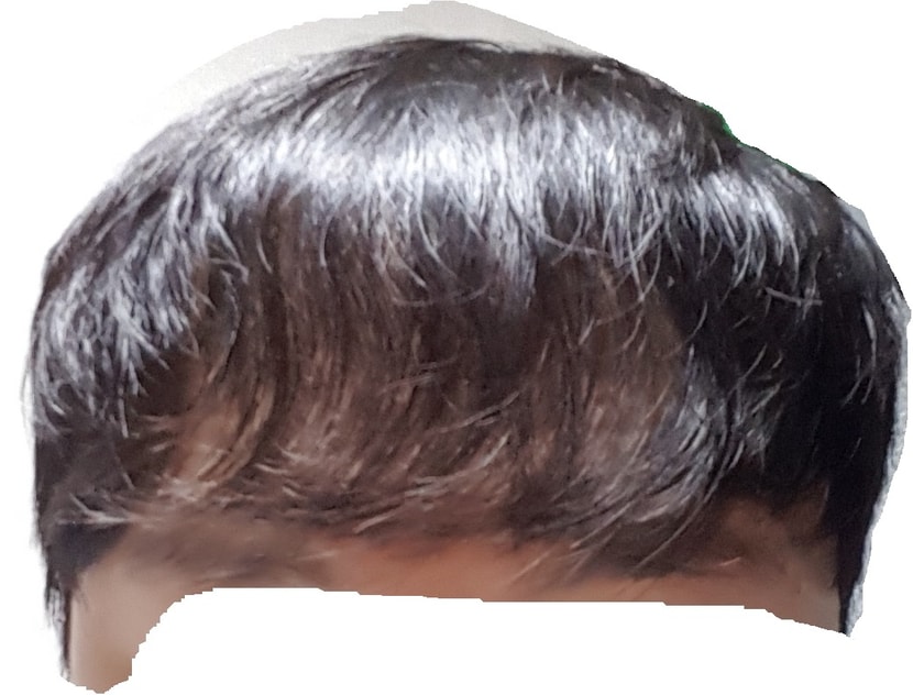 정면2