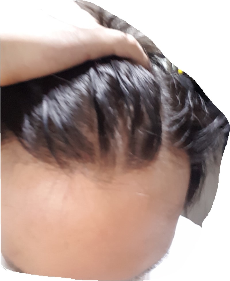 헤어라인.jpg
