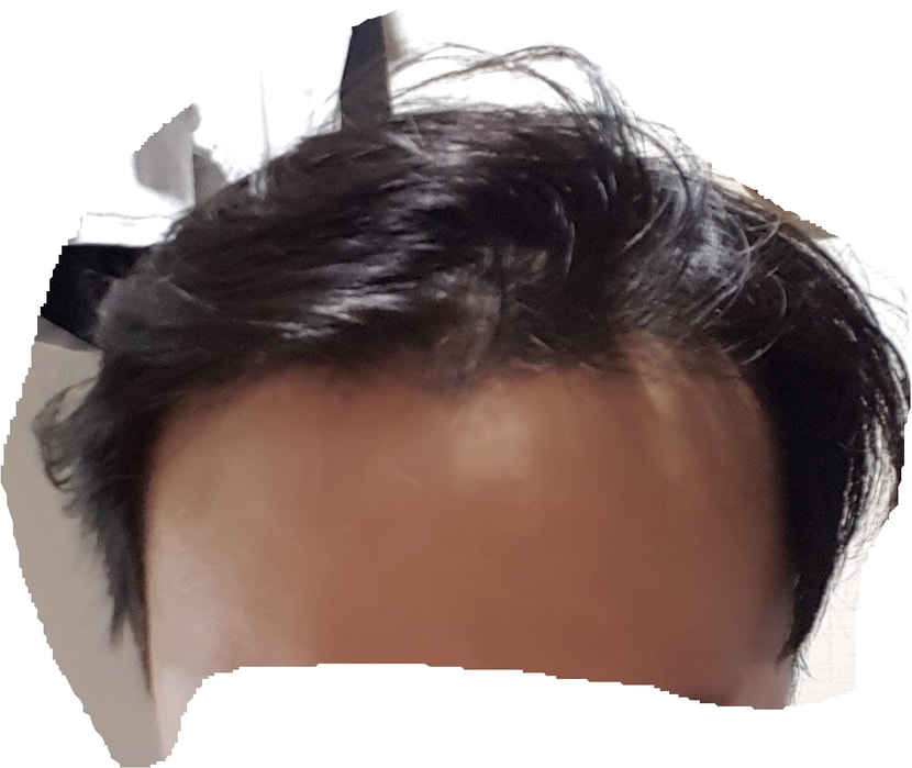 정면