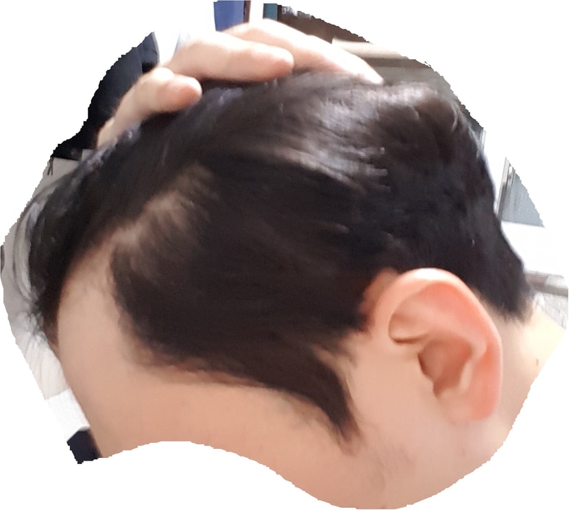 오른쪽