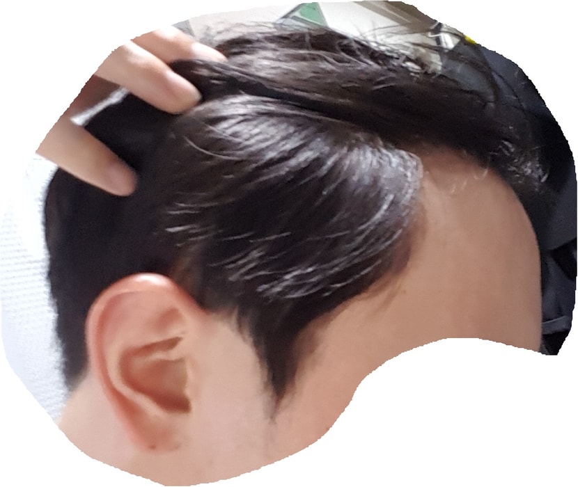 왼쪽