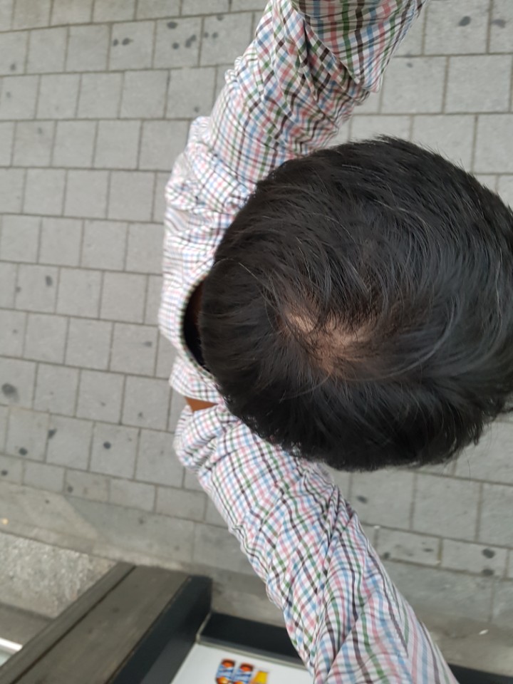 김탈모.jpg