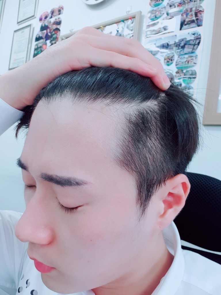 B612_20180722_134150_798.jpg