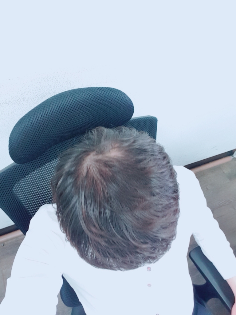 B612_20180717_112122_920.jpg