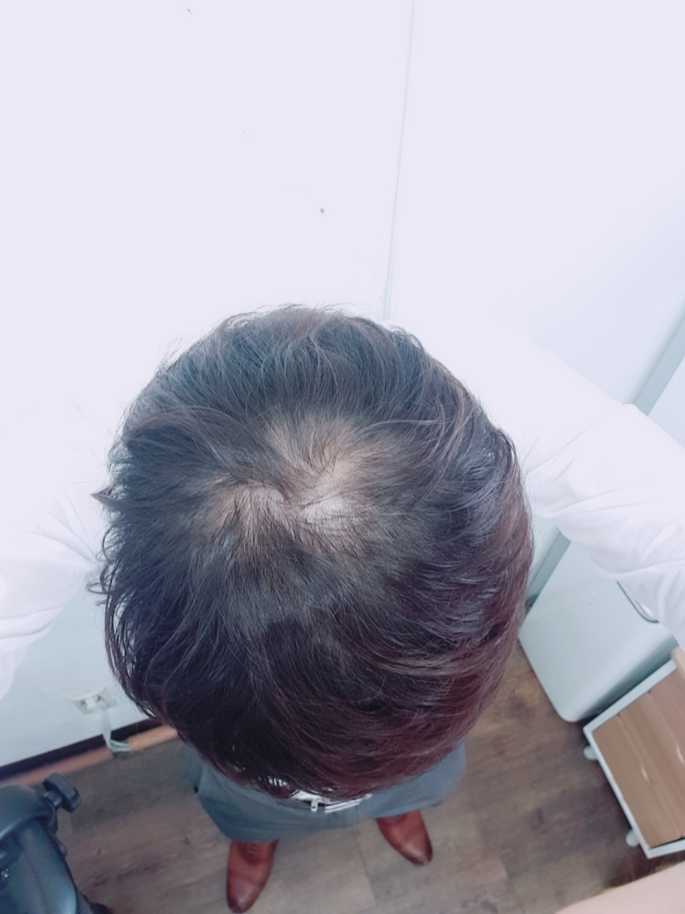 B612_20180724_152017_212.jpg