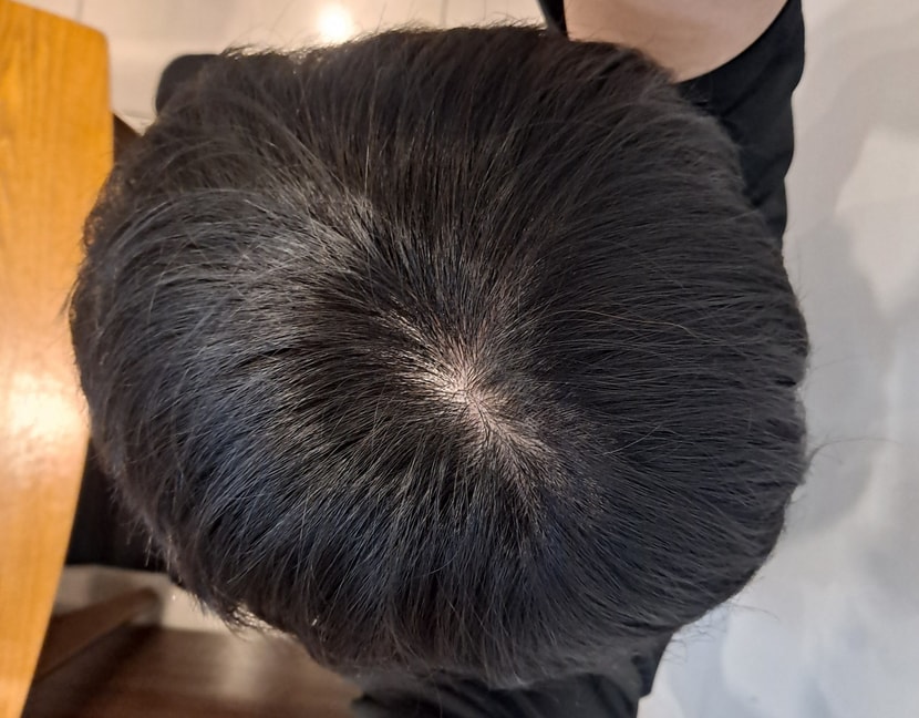 정수리