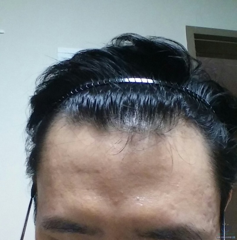 복용3개월3.jpg