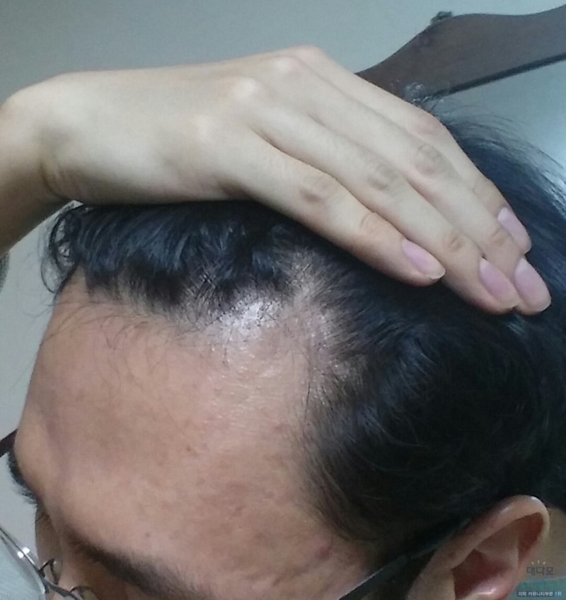 복용전1.jpg