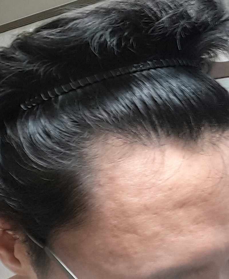 20170308_201253-1.jpg