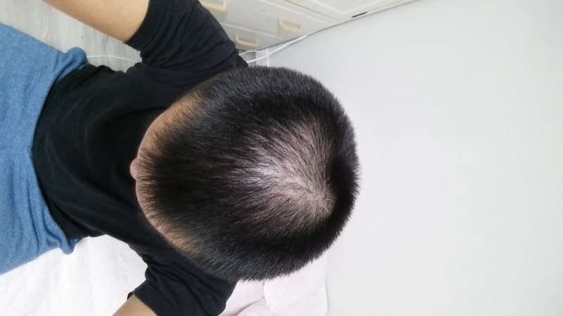 20170825_200824.jpg