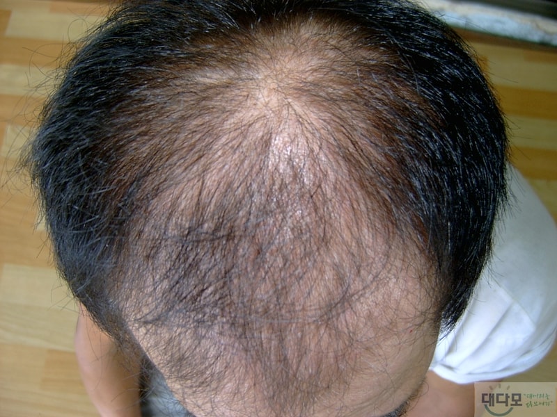 조영호정면정수리.JPG