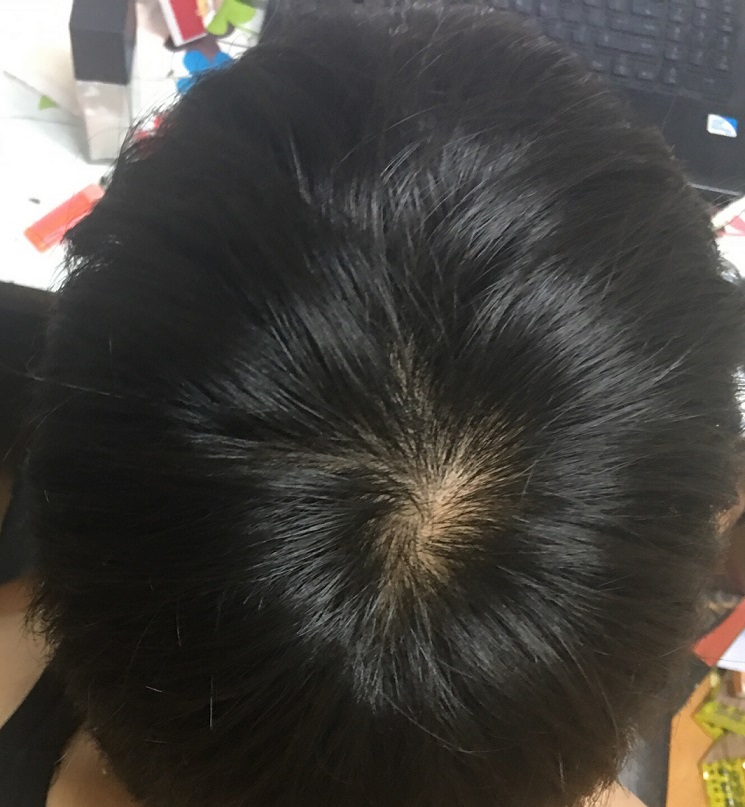 KakaoTalk_20160627_200929815.jpg