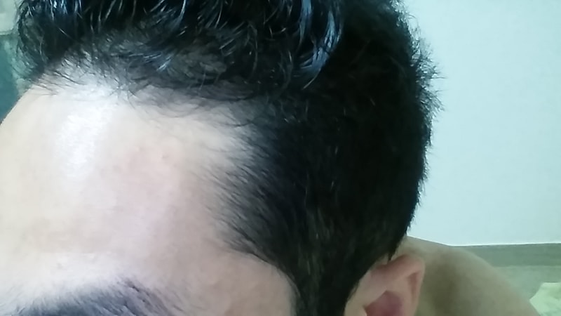20160703_175558.jpg