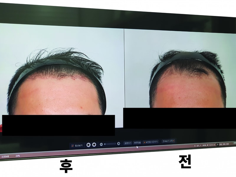 이마1-01.jpg