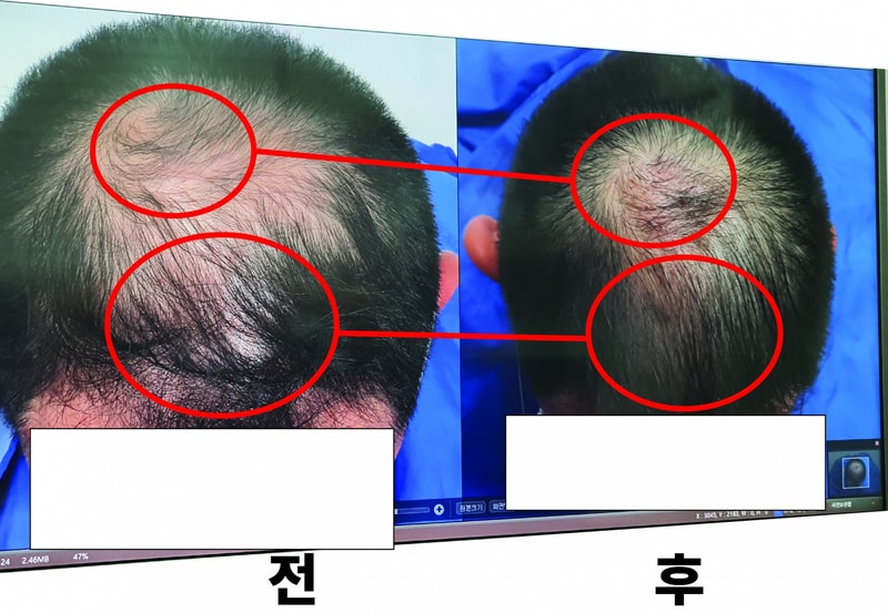 정수리-01.jpg