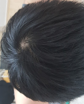 정수리.png