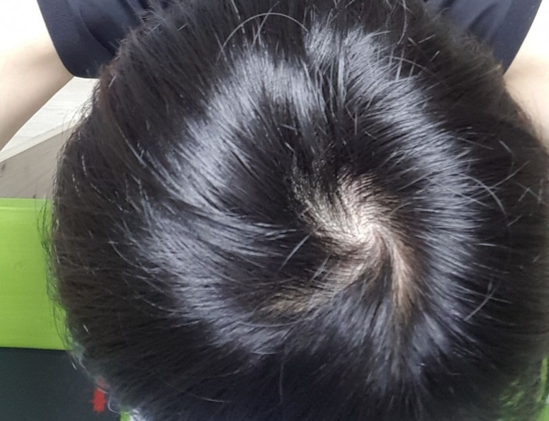 Resized_20180918_223244_7412.jpg