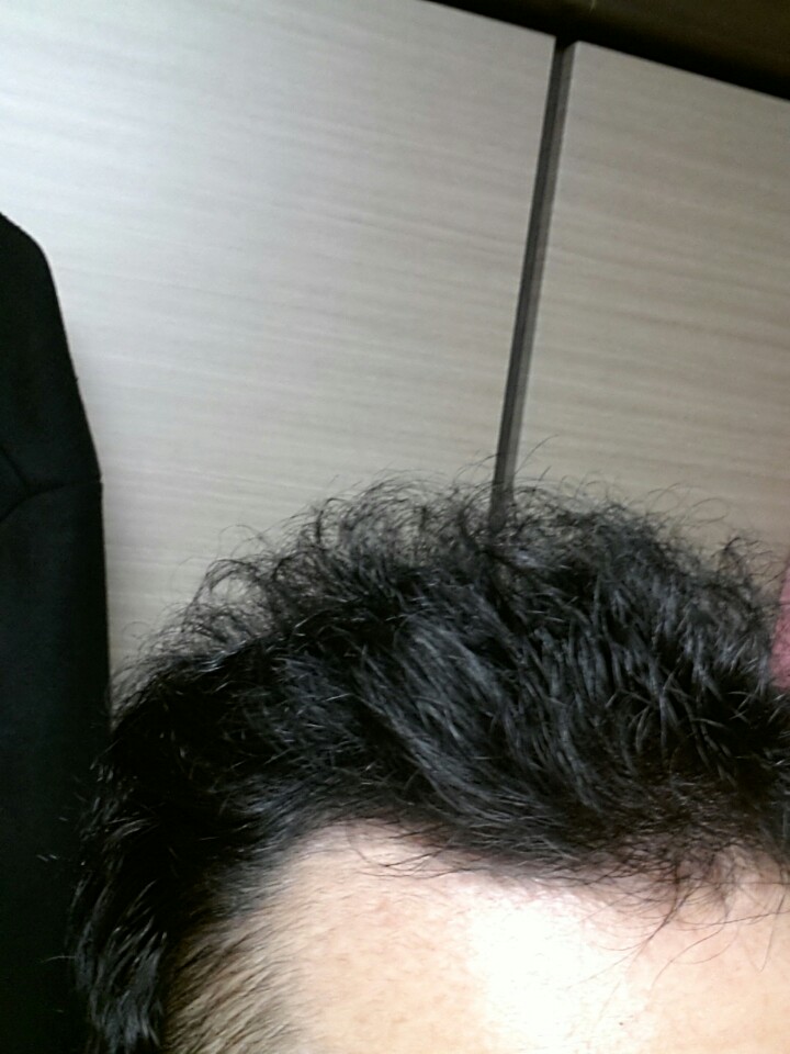 어제