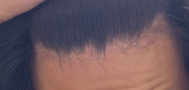 1000003204.jpg