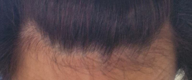 1000000647.jpg