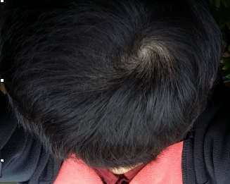 빛ㅊ.jpg