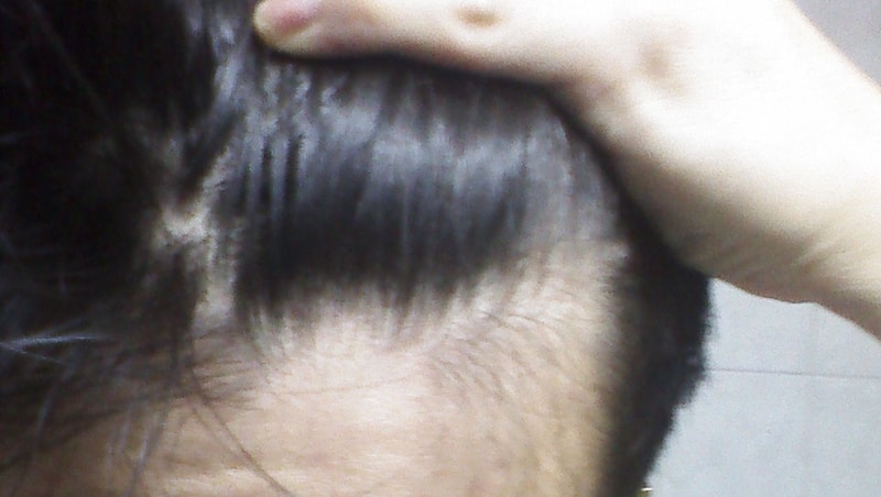 20170214_203314.jpg