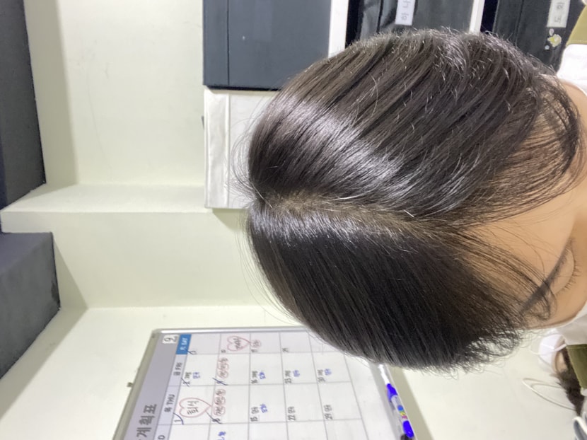 프로스카복용중