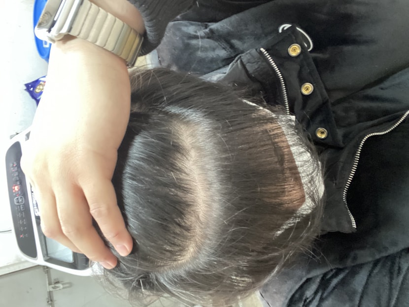 미노페시아 환승3달