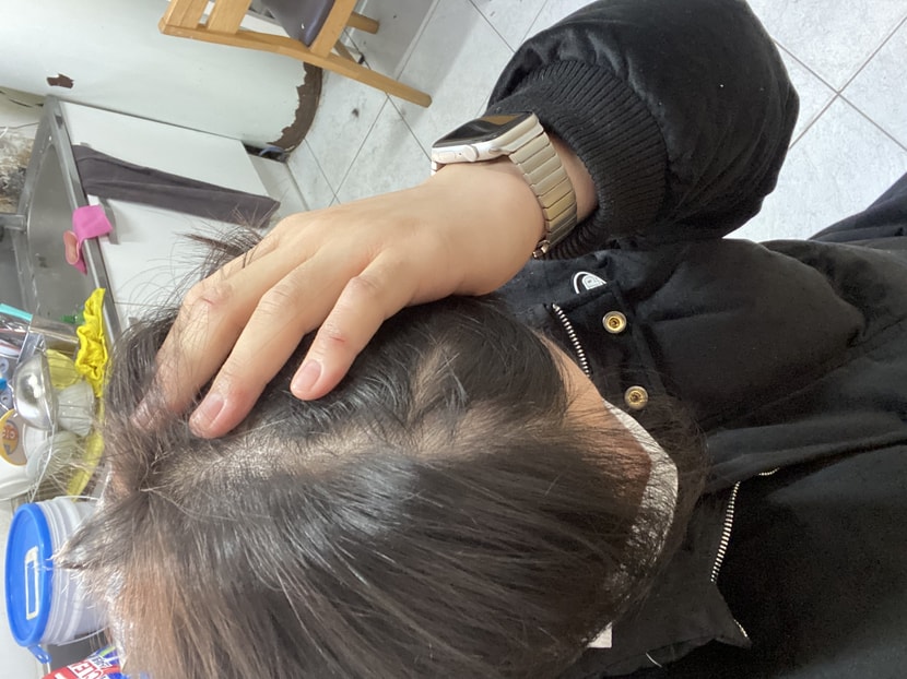 미노페시아 환승3달