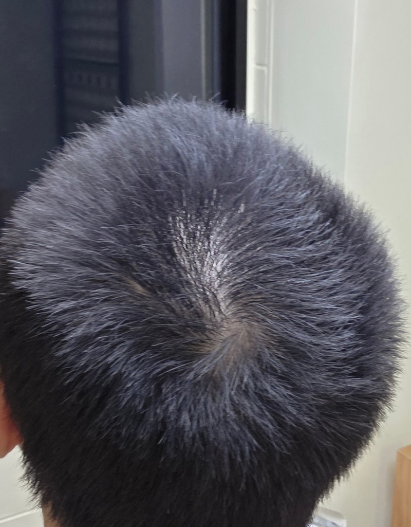 저 정수리 어느정도인가요..?