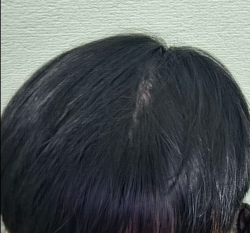 1000011557.jpg